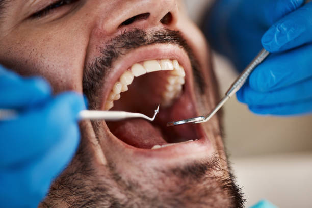 Best Emergency Dental Care for Trauma or Injury in Kendall Park, NJ